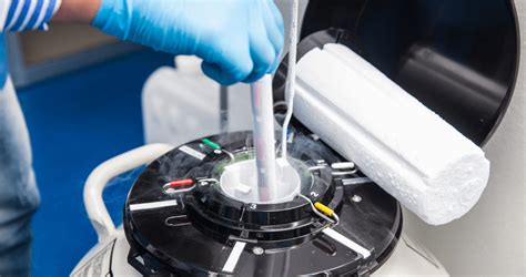 IVF baby’s first steps toward cryogenic sibling tanks